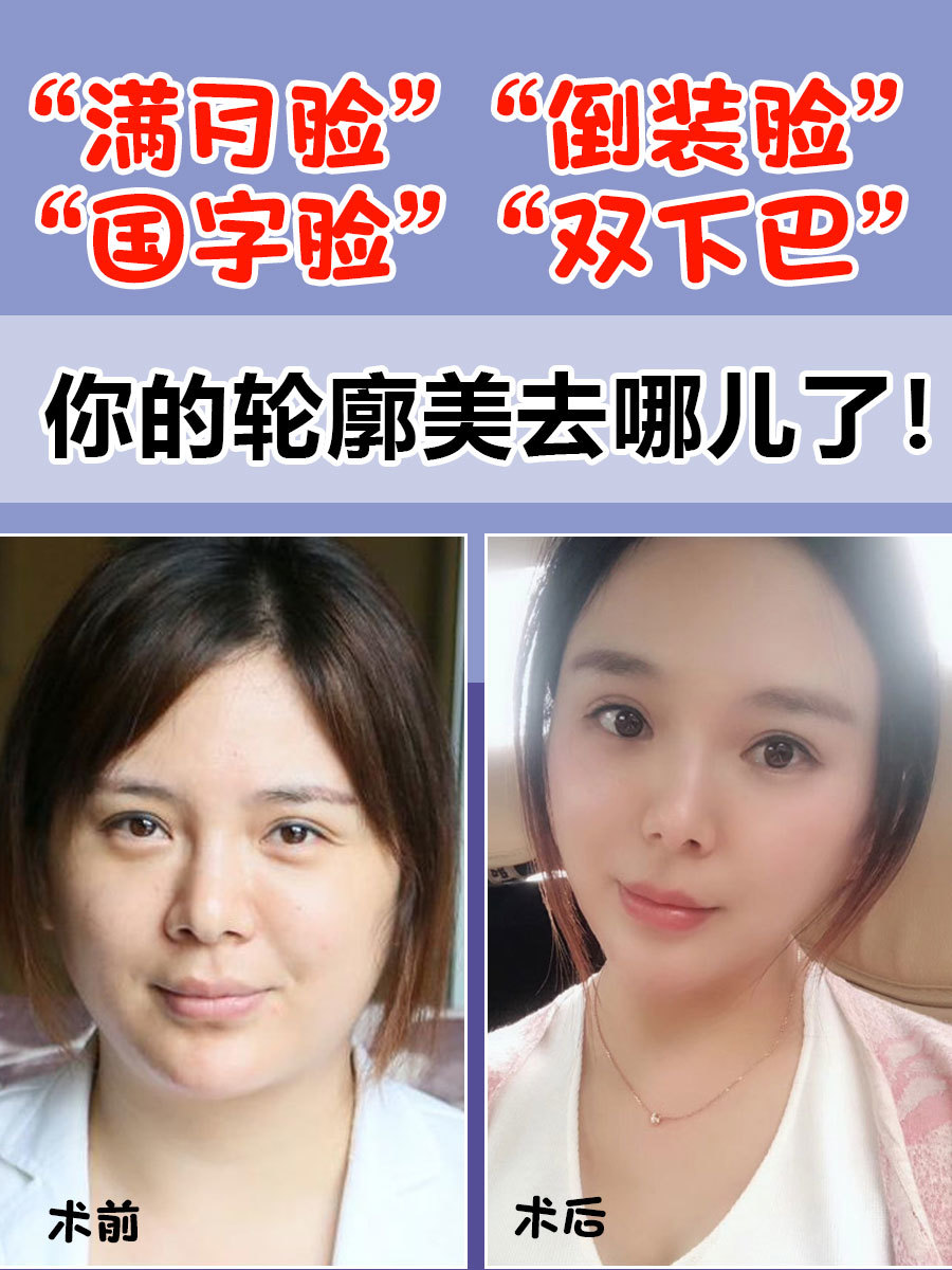 你的轮廓_圈子-新氧美容整形
