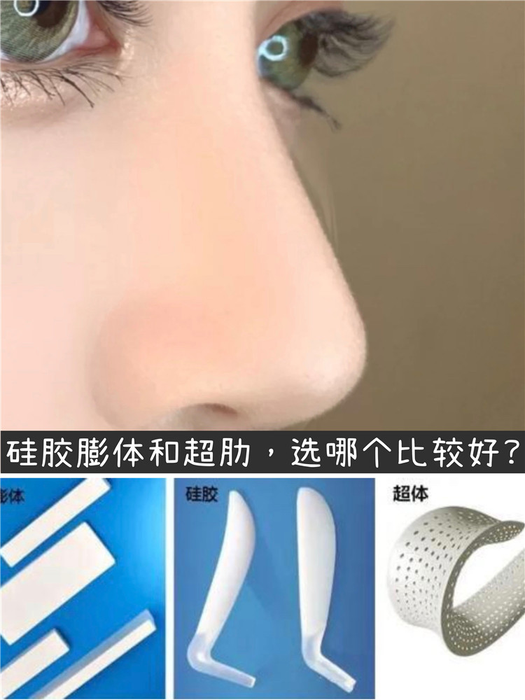 徐立志说隆鼻硅胶膨体和超肋选哪个比较好