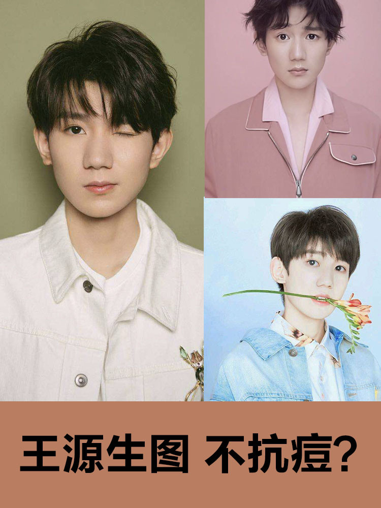 王源生图曝光,脸上重度痤疮一览无遗?