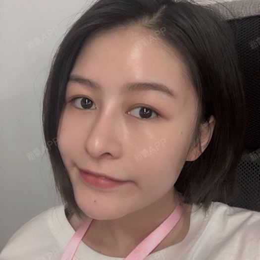 术后2个月——如今鼻子整体恢复的还是很好的,我是选_圈子-新氧美容