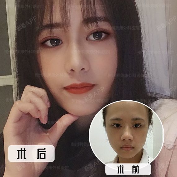 艺术鼻是很有气质的鼻型, 光从名字来看, 就知道这款鼻型的艺术气息
