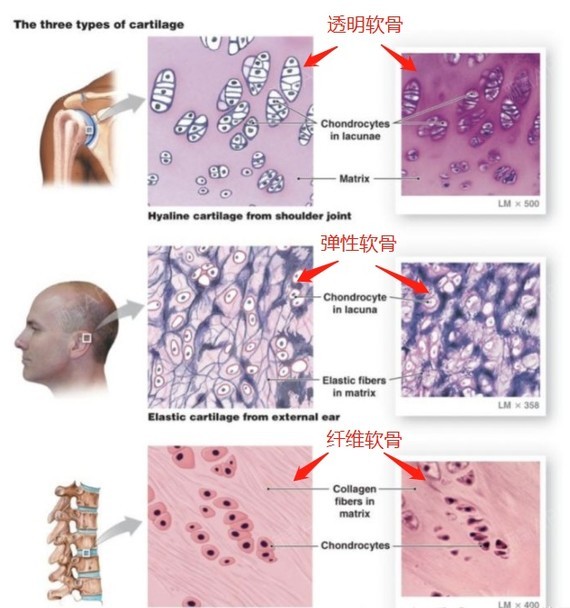 弹性软骨:软骨细胞位于基质中由弹性纤维构成的丝状网格中,故而弹性