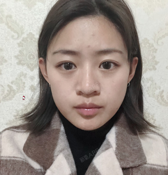 今天的我豁出去了,没有化妆,没有开美颜就拍了照片.