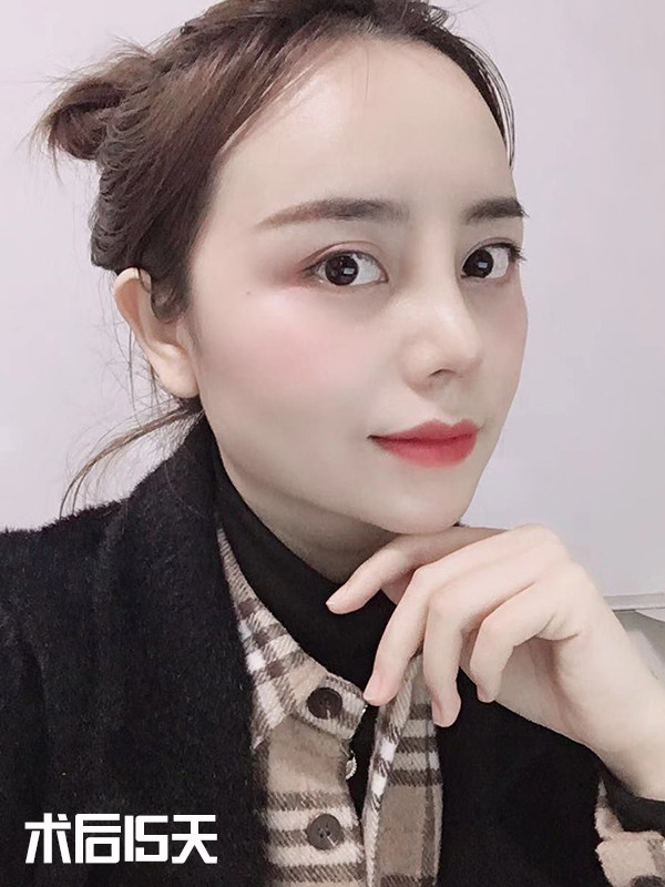 立体的鼻子能给五官加分很多原生的鼻子塌扁平视觉上都会让脸变大今天