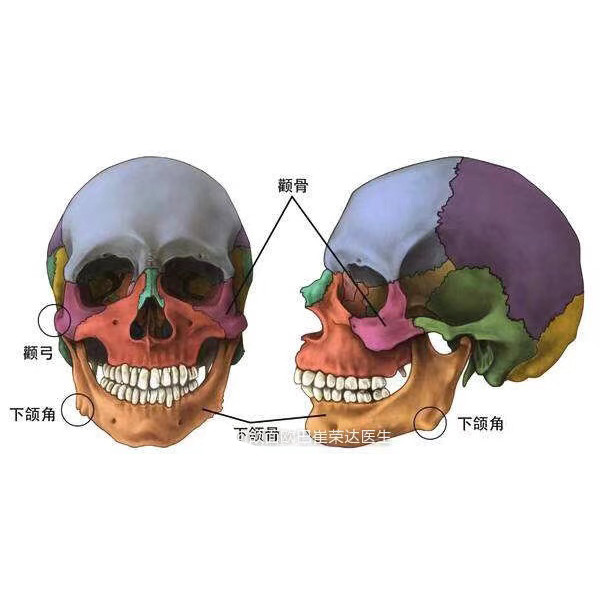 为了让颌面截骨部位骨头紧密相连,恢复的更好,我们通常会在颧骨手术