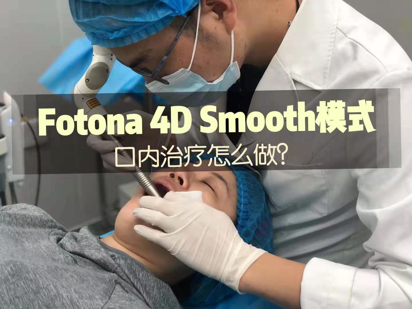 fotona 4d 什么要在口腔做?会痛吗?