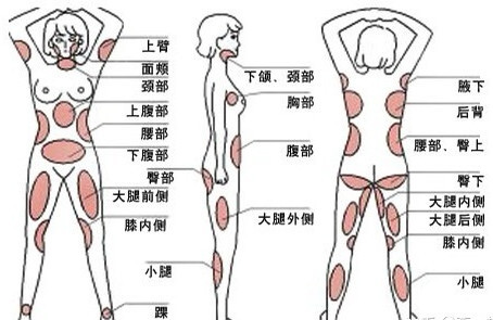 按部位分析: 脂肪主要堆积的部位主要有面部,上臂,腰腹