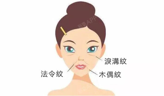 只知道法令纹鱼尾纹会暴露我们的年龄,但是你听说过木_圈子-新氧美容