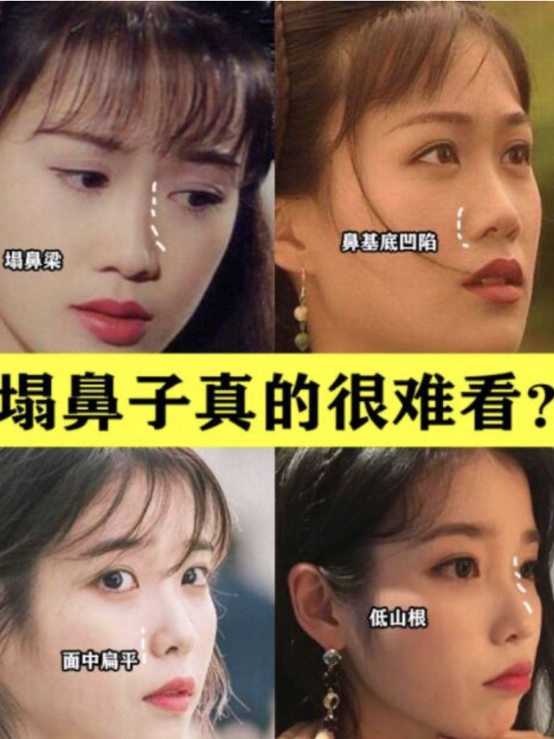 塌鼻子真的很丑吗