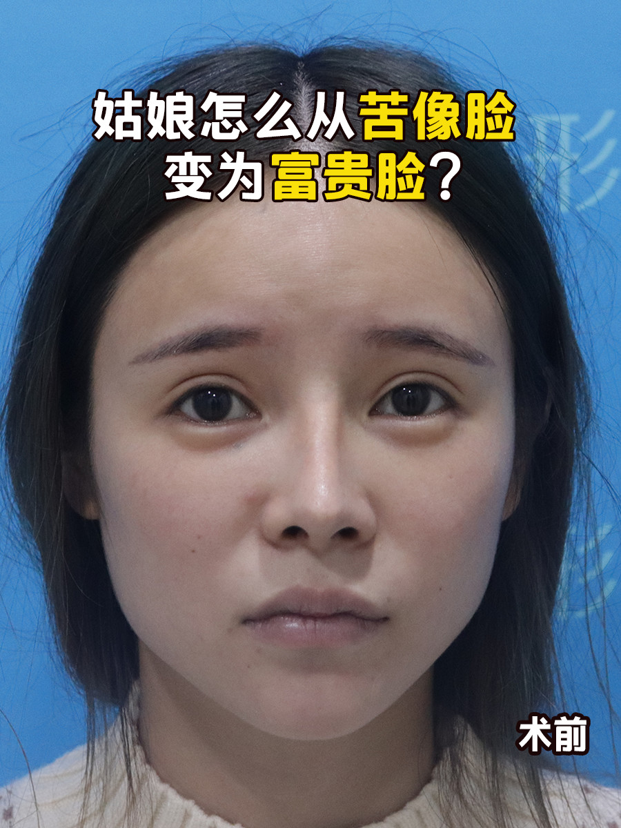 盘点苦相脸特征到底如何?宝宝们跟我一起来看下吧!  .