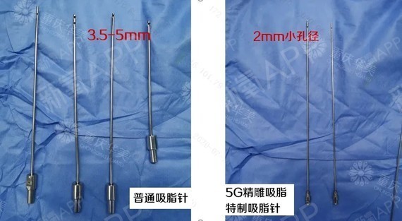 5-5mm的钝性针头,而5g精雕吸脂用的是2mm小孔径锐性吸脂针.