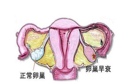 卵巢功能衰退有哪些症状震惊怎么调理?