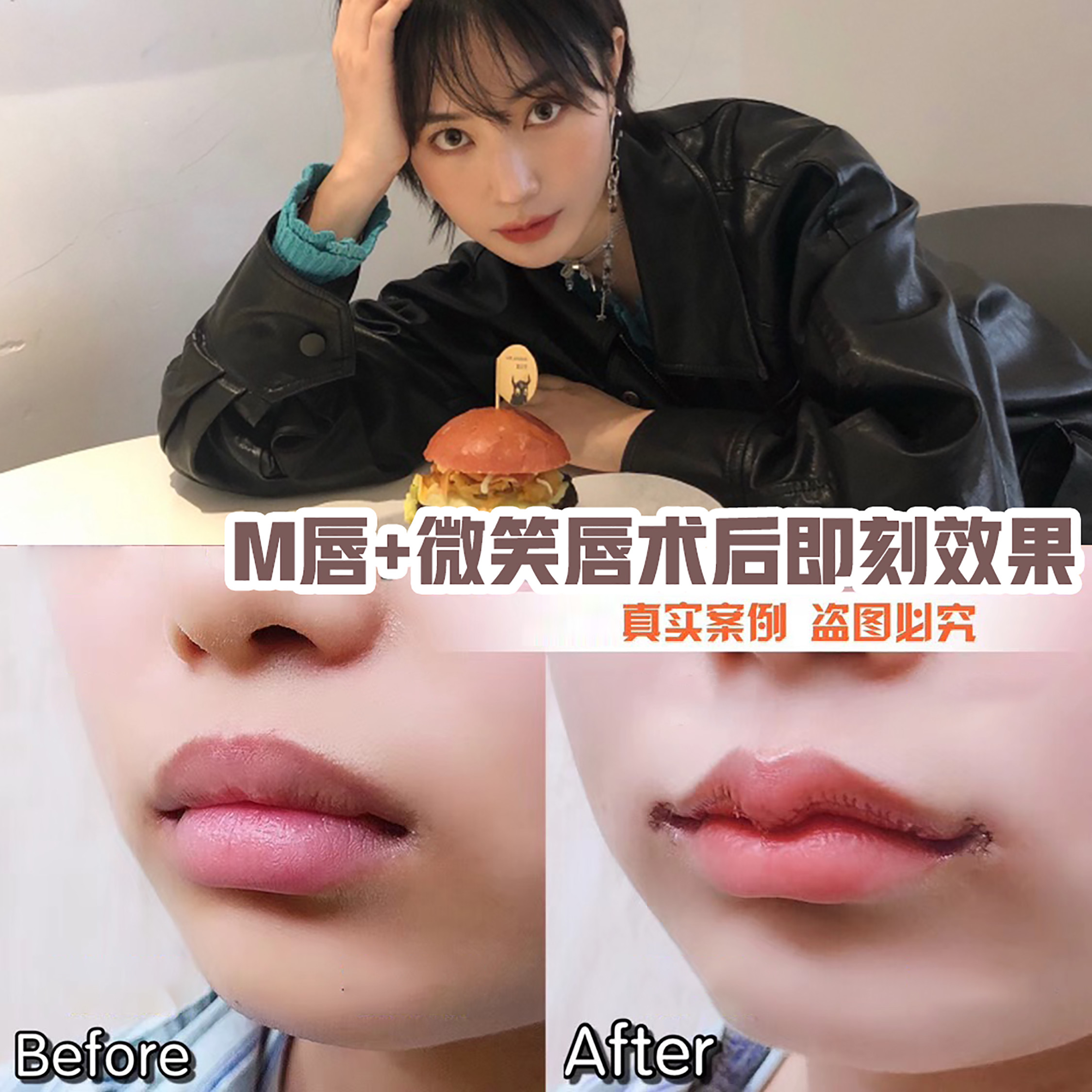 你也可以拥有好看的花瓣唇