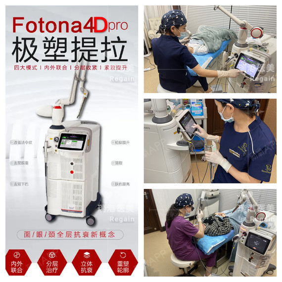 工作原理:欧洲之星fotona4d pro:利用激光对皮肤多层次进行间接性