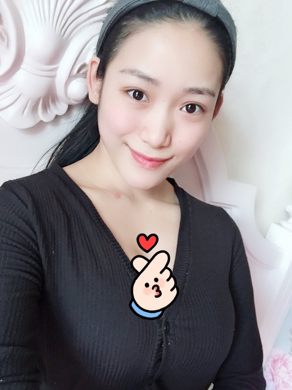 今天的案例是一位因哺乳后乳房萎缩,缩水,前来了解丰胸的年轻妈妈.