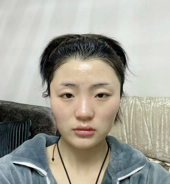方块脸,咬肌肥大