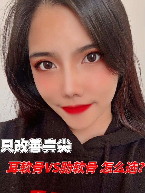 耳软骨和肋软骨哪个更适合垫鼻尖原因