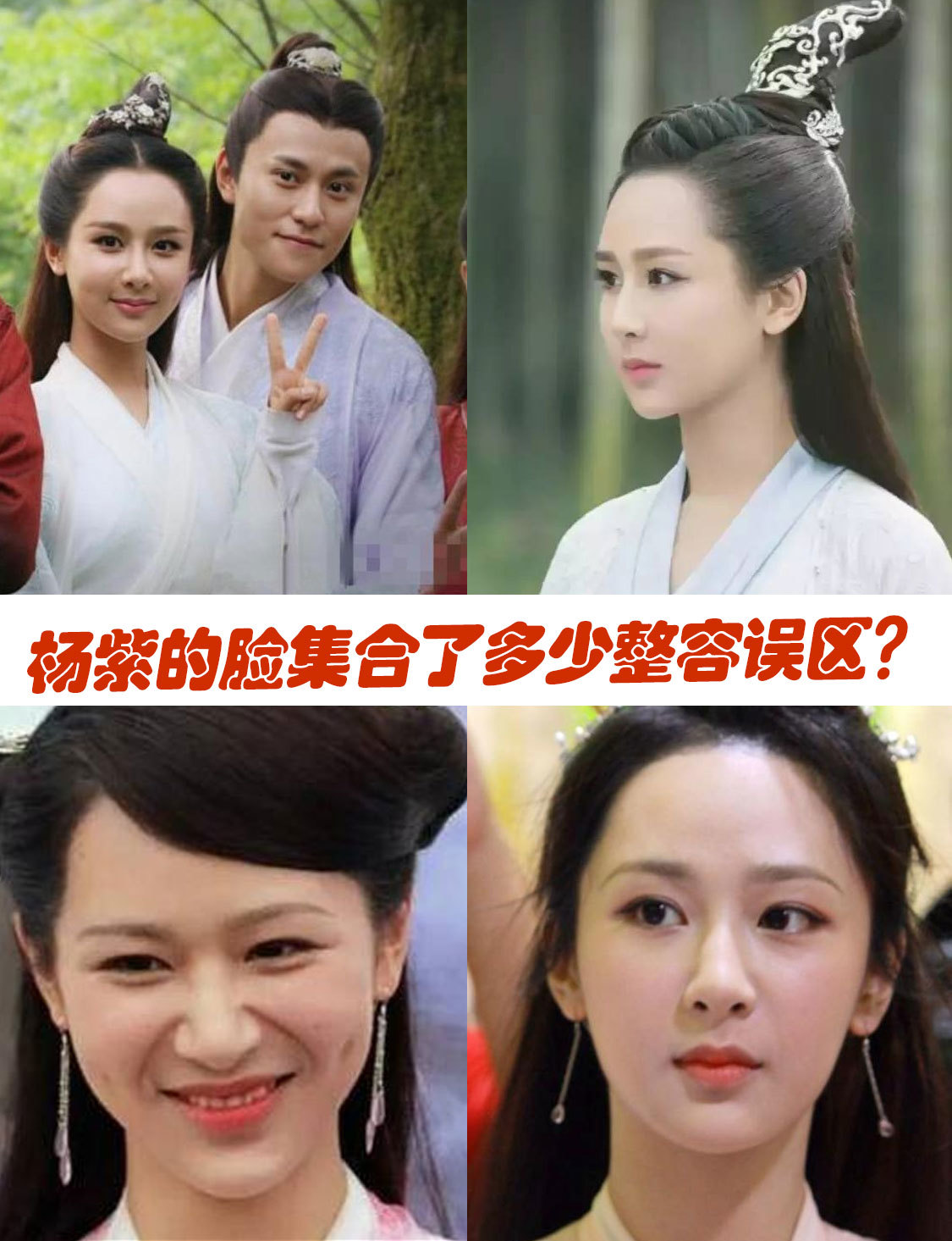 杨紫的脸集合了多少整容误区?