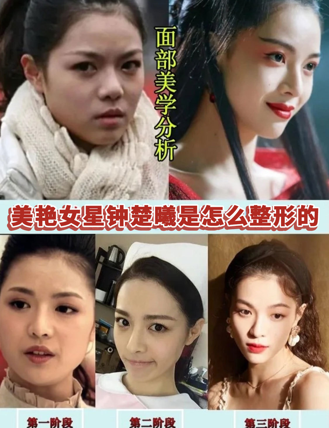 美艳女星钟楚曦是怎么整形的