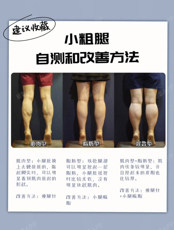 16615肌肉型97自测方法:小腿肚摸上去硬鼓鼓的,踮起脚尖时,可以