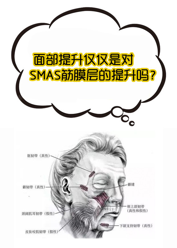 【面部提升仅仅是对smas筋膜层的提升吗?】