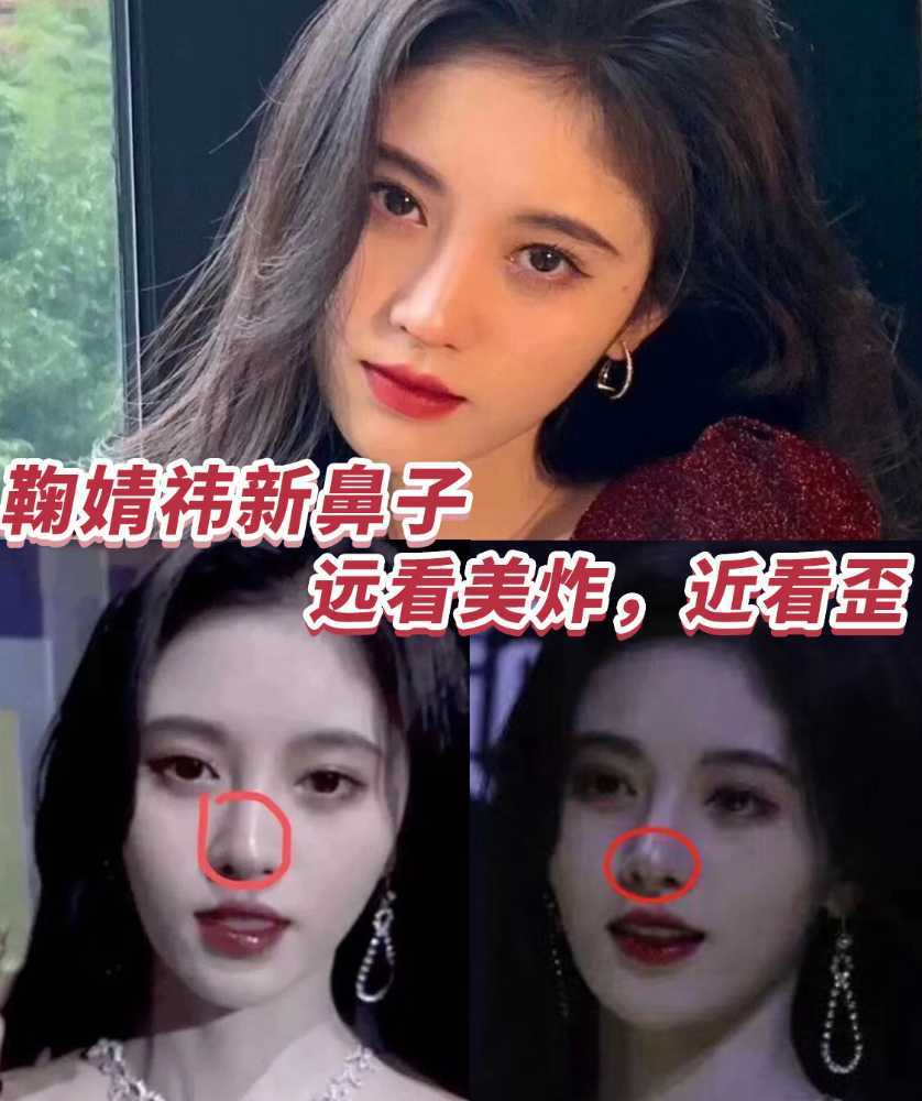 鞠婧祎新鼻子远看美炸,近看歪是什么原因?