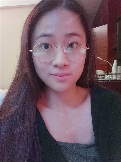注射瘦脸好不好_效果图_玲动天下注射瘦脸术后第35天