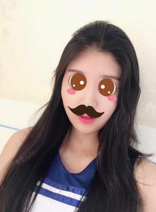 是我想太多v自体脂肪全脸填充第56天美丽日记