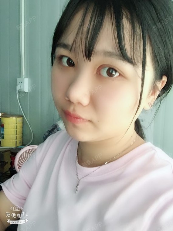 阿尔法的猫切开双眼皮第95天美丽日记-新氧美