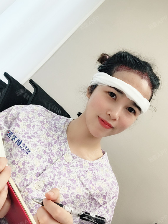 15172164756978.code.monkey种植发际线第0