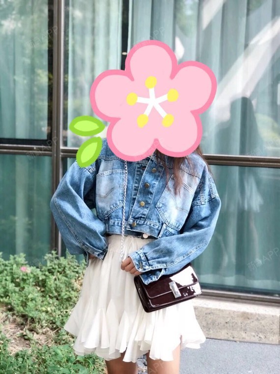 氧气0576091515578344手术紧缩阴道第17天