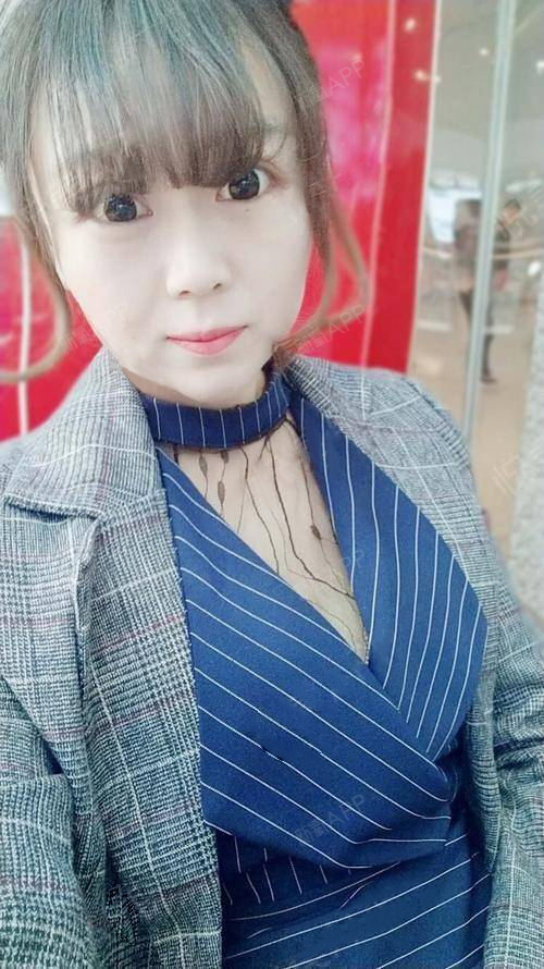 氧气xi2fu肉毒素去法令纹第1天美丽日记-新氧美