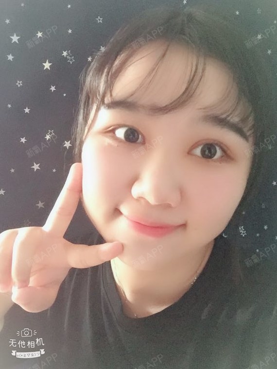 阿尔法的猫切开双眼皮第100天美丽日记-新氧美