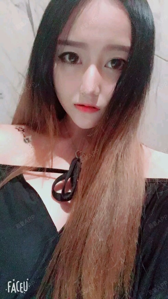 黑暗角落里玻尿酸隆鼻第5天美丽日记-新氧美容