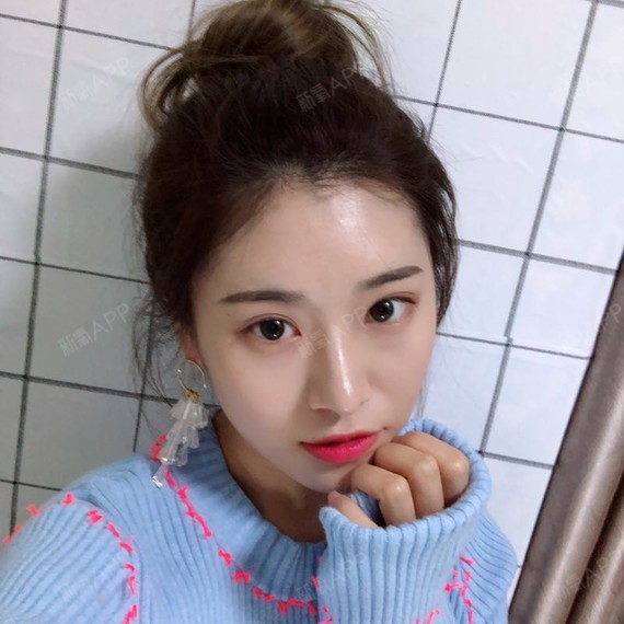 氧气4869281508142354半永久纹发际线第6天