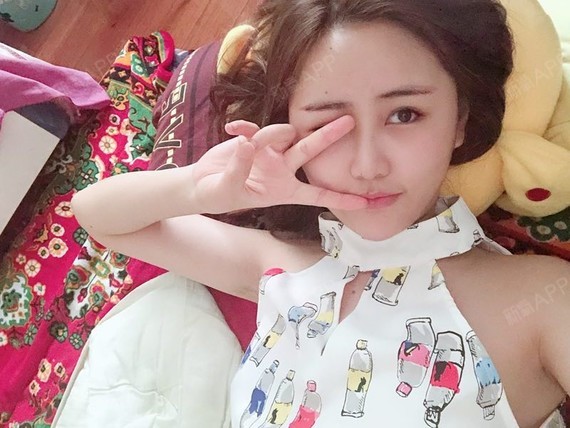 小甜宝自体脂肪全脸填充第39天美丽日记-新氧