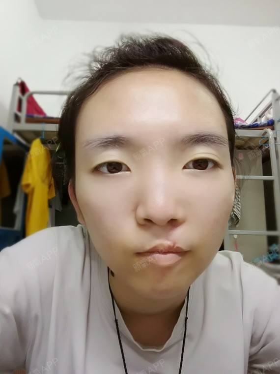 在家养了一个多月已经不在忌口,现在也开学10多天的