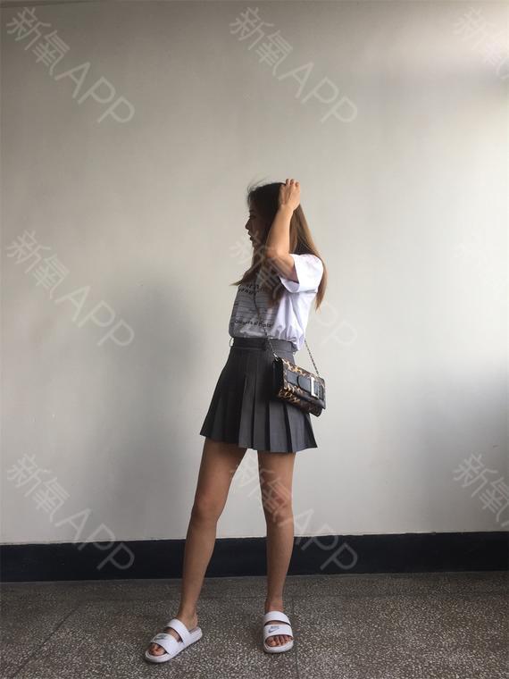 能够让腿型恢复到一个非常好的状态也收到了四面八方同事们的慰问一