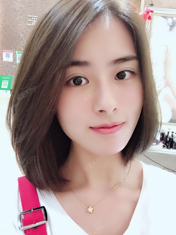 氧气美女女女女女女子自体脂肪全脸填充第107天美丽日记-新氧美容整形