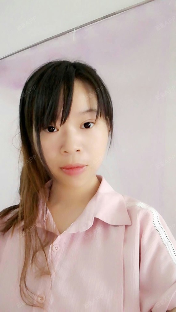 风になる定点双眼皮第2天美丽日记-新氧美容整