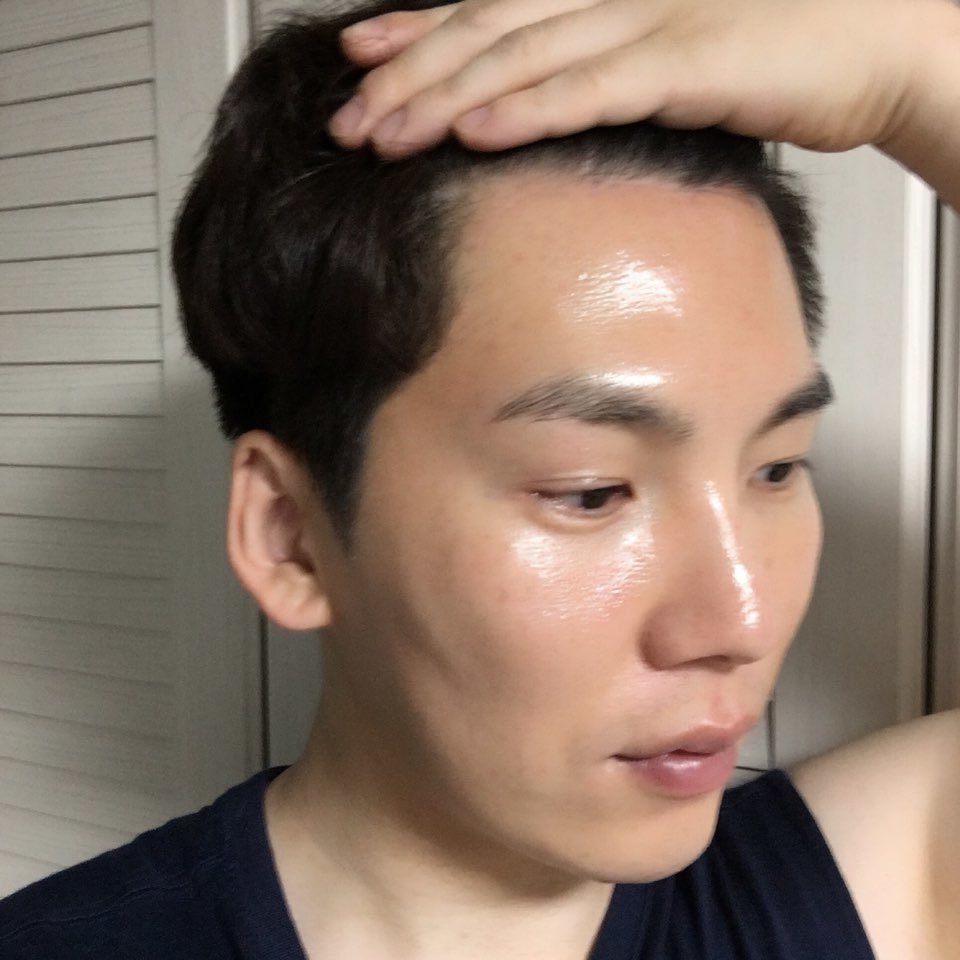 像我一样额头宽不敢露额的朋友们,你们可以挑战一下做额头缩小!