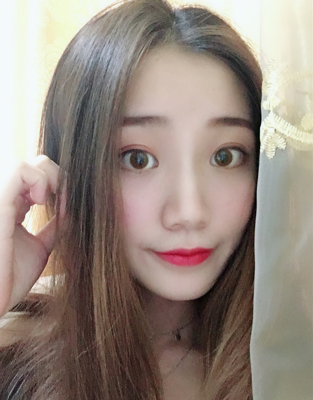 切开双眼皮第40天
