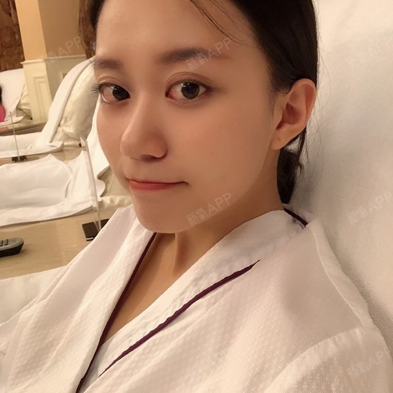 嘟嘟嘴丫美丽日记-新氧美容整形