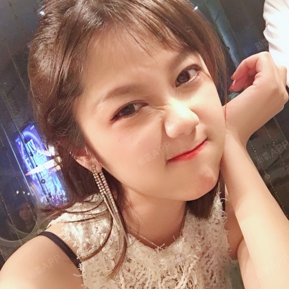 小小鹿乱乱撞自体脂肪丰额头第77天美丽日记