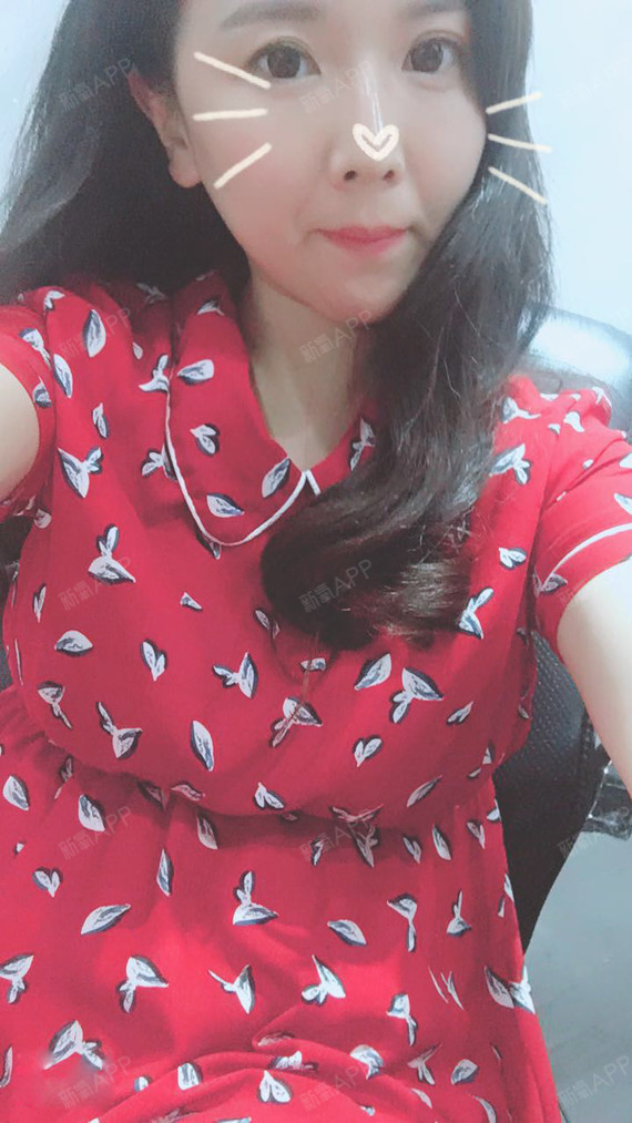 Miss羊羊吸脂瘦手臂第31天美丽日记-新氧美容