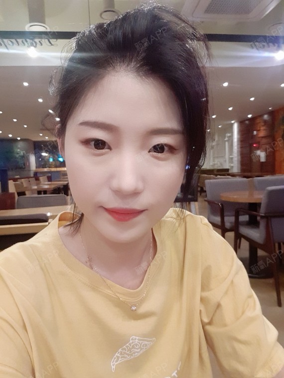 最值钱的还是脸颧骨颧弓整形术第155天美丽日