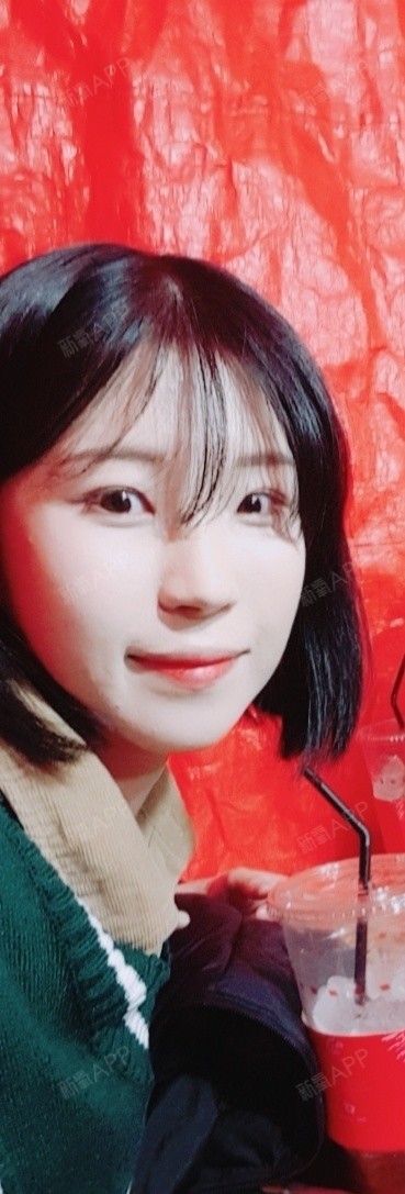 最值钱的还是脸颧骨颧弓整形术第155天美丽日