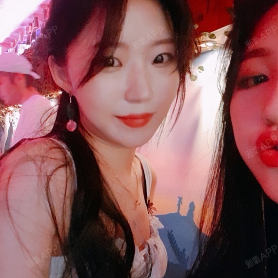 最值钱的还是脸颧骨颧弓整形术第199天美丽日