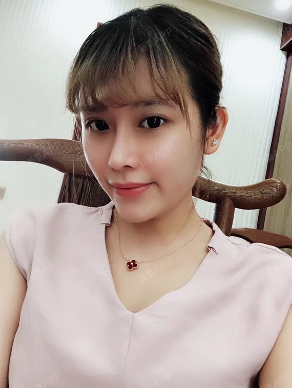 傲视去鼻综合第83天美丽日记-新氧美容整形