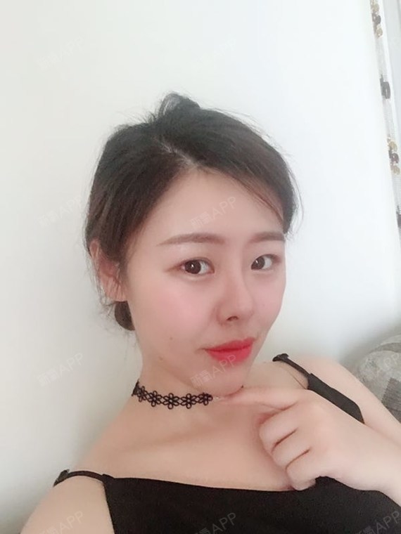 去吧皮卡皮卡丘耳软骨复合隆鼻第297天美丽日